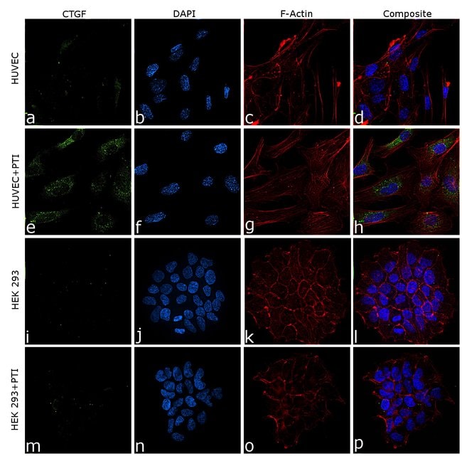 100uL Polyclonal antibody, CTGF, host ra