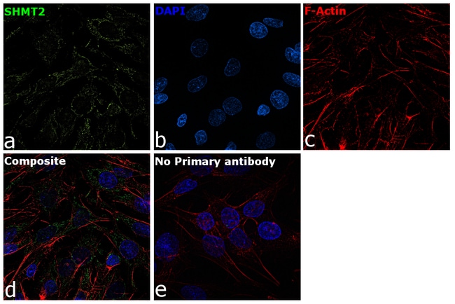 100uL Polyclonal antibody, SHMT2, host r