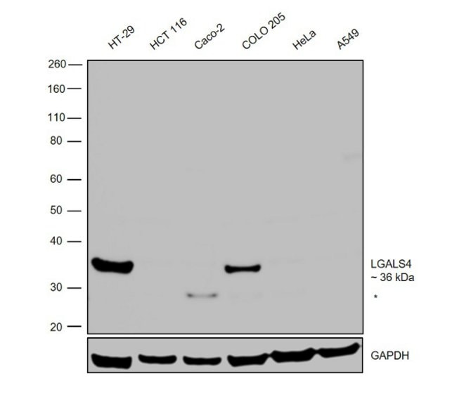 100uL Polyclonal antibody, galectin4, ho