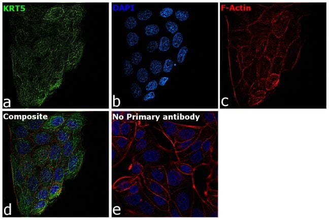 500uL Polyclonal antibody, keratin 5, ho
