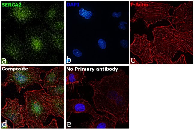 100 UG SERCA2 ATPase Polyclonal Antibody
