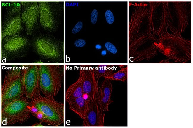 100UL BCL-10 ANTIBODY 100 ul