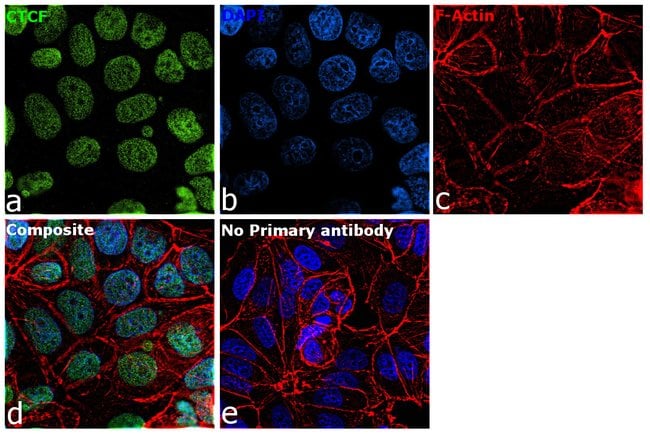 100UL CTCF ANTIBODY 100 ul