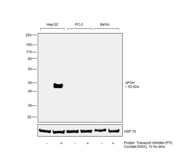 100UL APOLIPOPROTEIN H ANTIBODY 100 ul