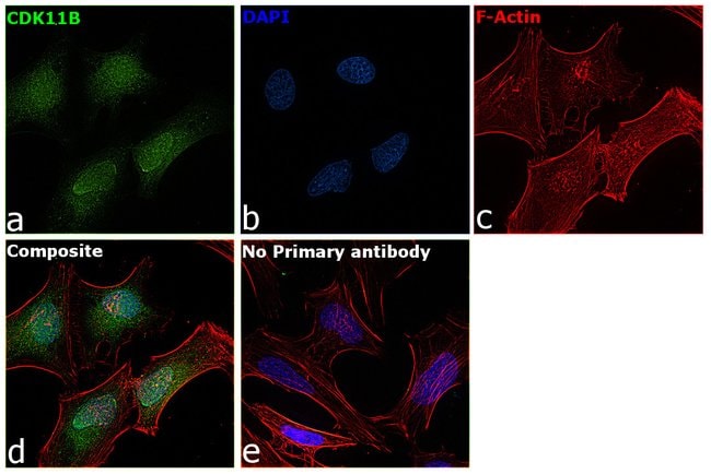 100UL CDK11B ANTIBODY 100 ul