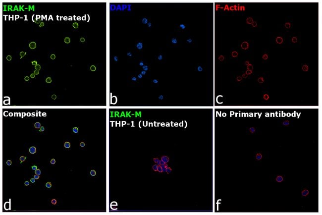 100UL IRAK-M ANTIBODY 100 ul