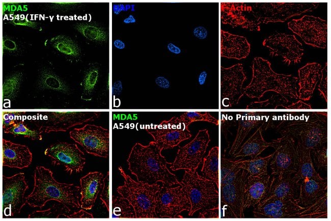 100UL MDA5 ANTIBODY 100 ul