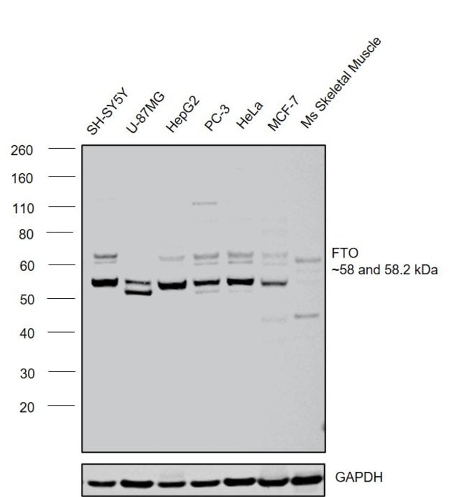 100UL FTO ANTIBODY 100 ul