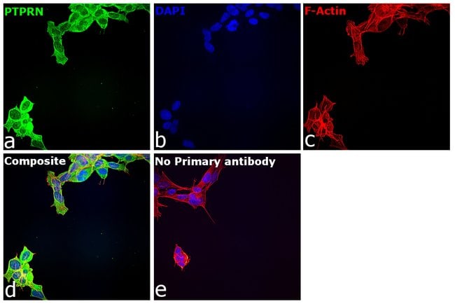 100UL IA2 ANTIBODY 100 ul