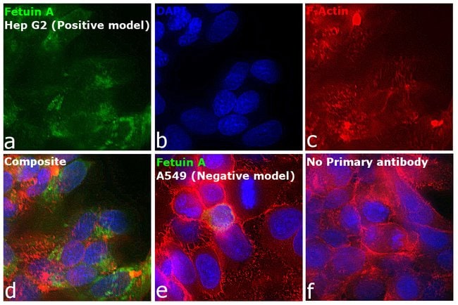 100UL FETUIN A ANTIBODY 100 ul