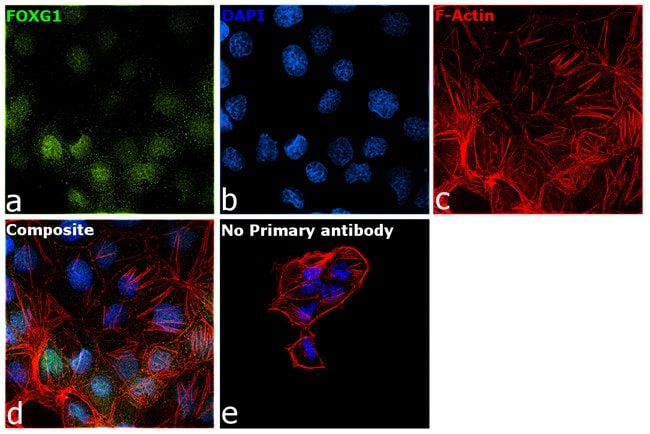 100UL FOXG1 ANTIBODY 100 ul