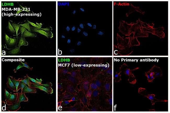 100UL LDHB ANTIBODY 100 ul