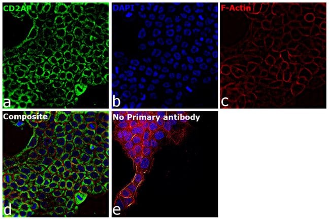 100UL CD2AP ANTIBODY 100 ul