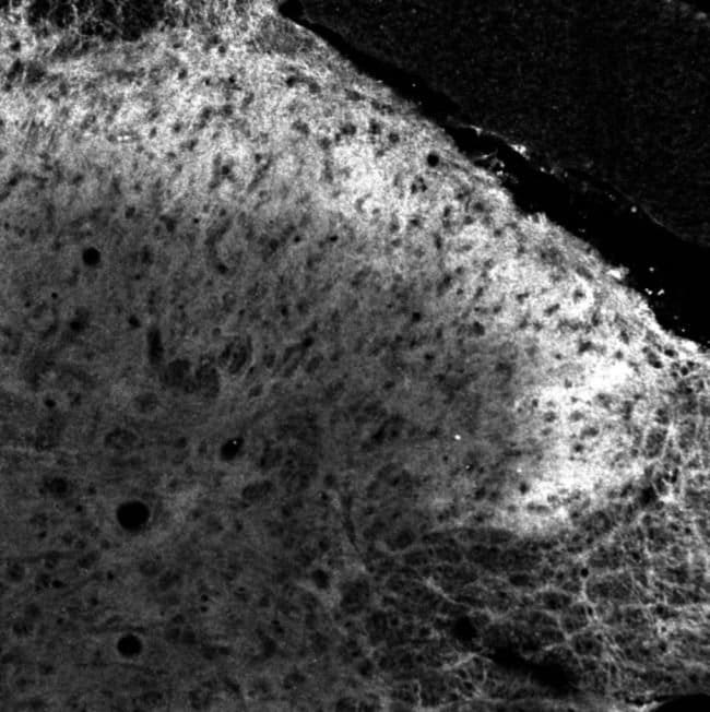 100 UL POLYCLONAL ANTIBODY, ANTI-PACAP T