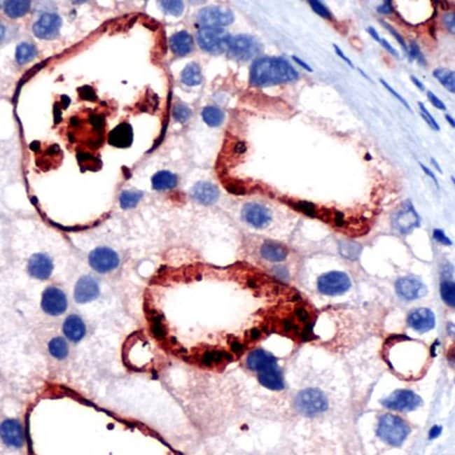 Anti-PSMA