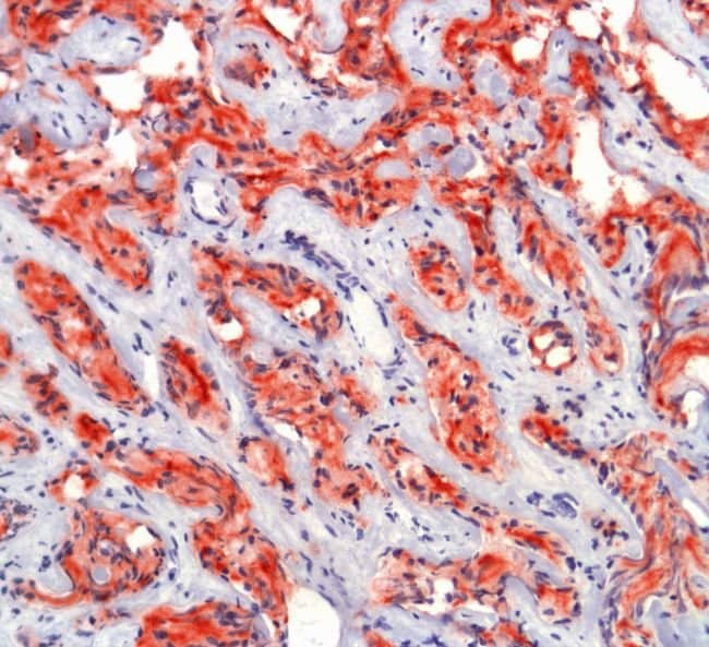 500uL Polyclonal antibody, PSMA, host ra