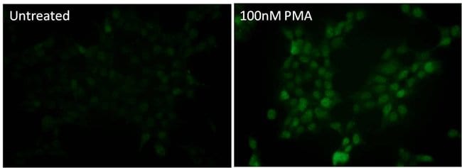 200UL PHOSPHO-P38 MAPK (THR180/TYR182) .