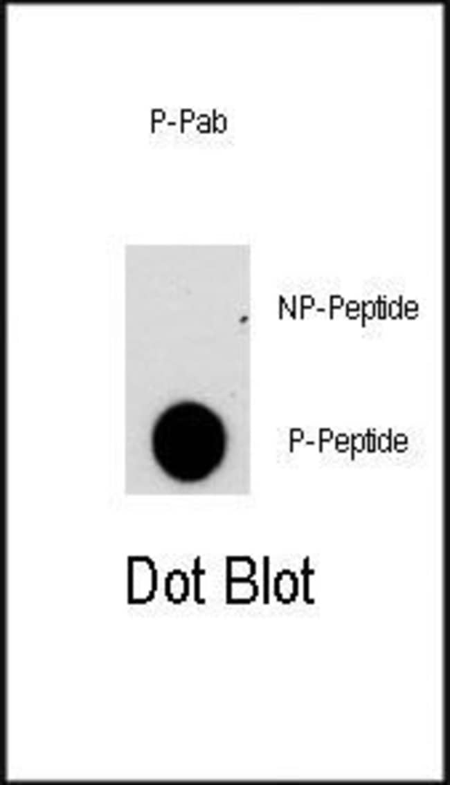 Anti-Phospho-NFATC2-pS330 0.1 mg MG