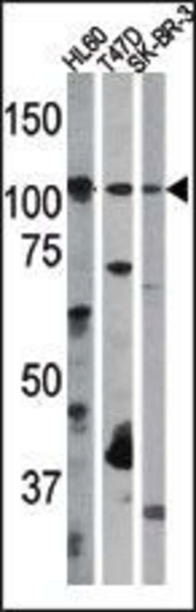 ANTI-PHOSPHO-RB-S612, 0,1mg .