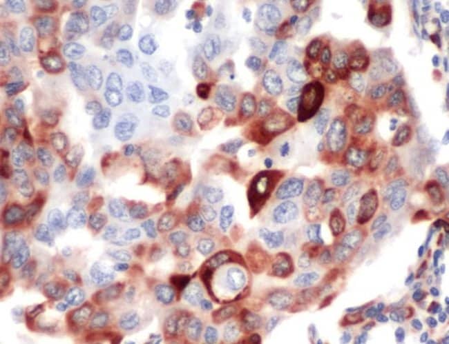 ANTI-PHOSPHO-S6 RIBOSOMAL PSER235/236