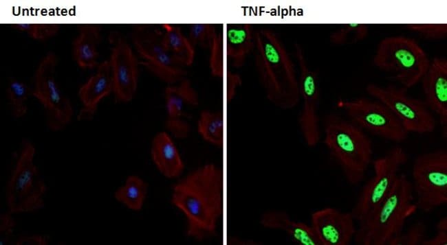 100UL PHOSPHO-P38 MAPK (THR180/TYR182) .