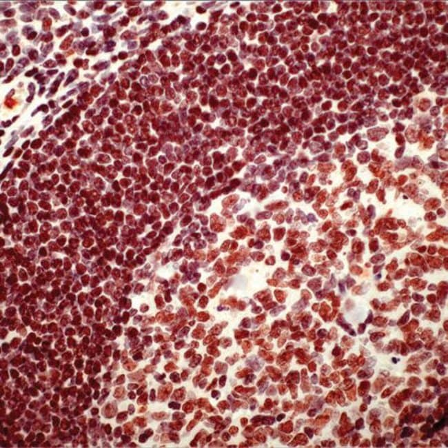 1 ML PARP Rabbit polyclonal antibody IgG