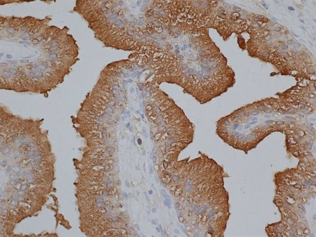 1 ML Prostate Specific Antigen Sheep pol