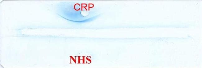 10MG C-reactive protein .