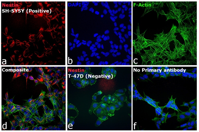 AF 594 DK ANTI-MS IGG AB, READYPR. REAG.