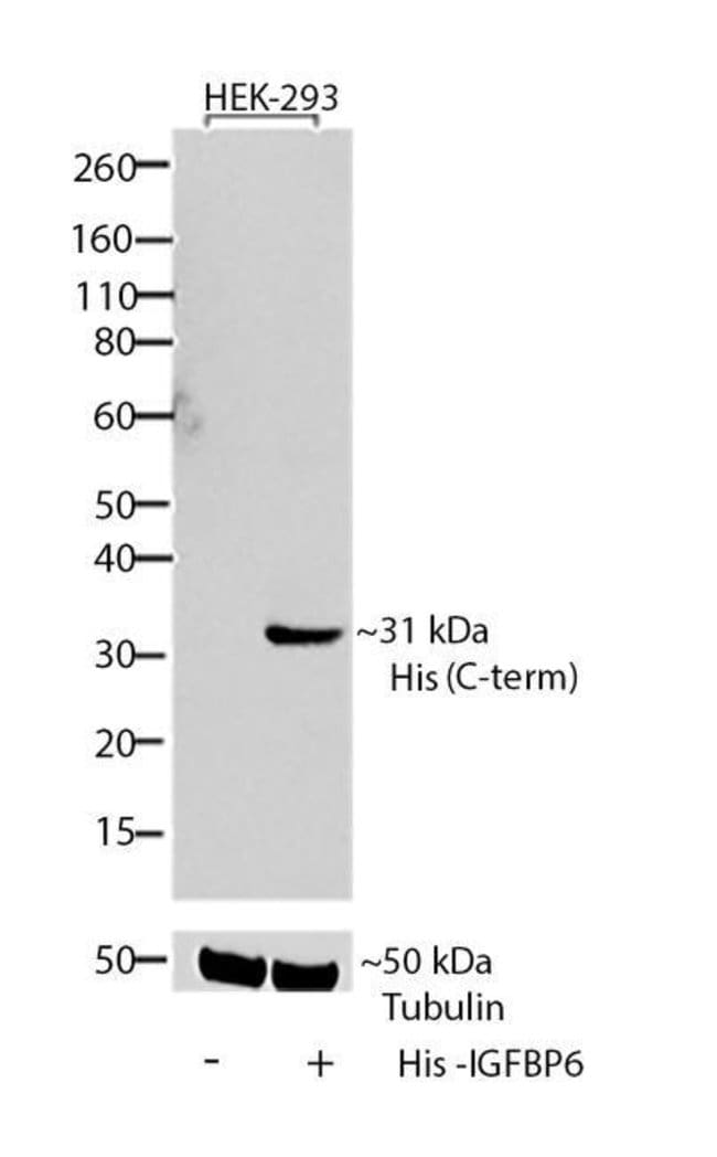 Anti-His(C-term)-HRP Antibody, 50 µl The