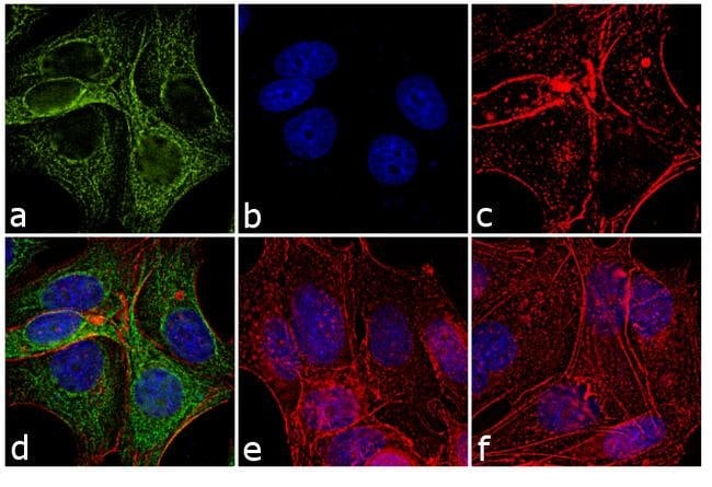 RABBIT ANTI-MOUSE IGG (H+L), CROSS ABSOR