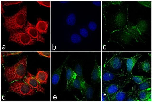 RABBIT ANTI-MOUSE IGG (H+L), CROSS ABSOR