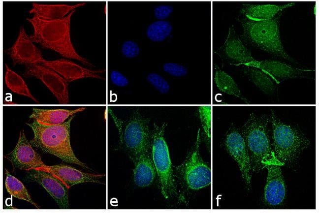 GOAT ANTI-MOUSE IGG (H+L), CROSS ABSORBE