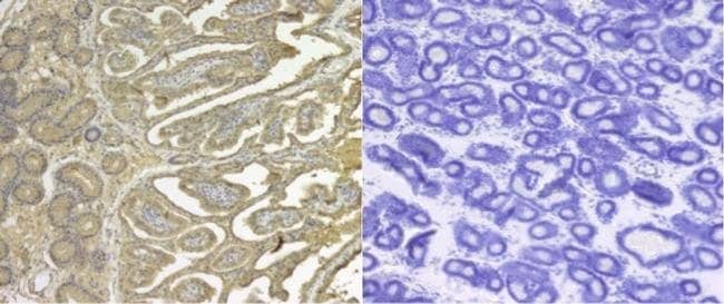 100uL Polyclonal antibody, SERPINE2, hos