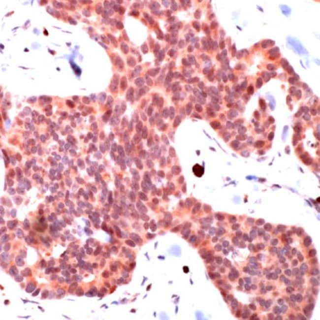 500uL Polyclonal antibody, SMAD3, host r