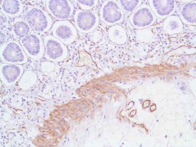 500uL Polyclonal antibody, SMA, host rab