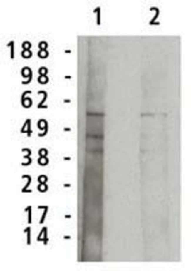 ACID SPHINGOMYELINASE