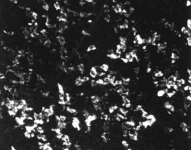 100 UL POLYCLONAL ANTIBODY, ANTI-SSTR5 S
