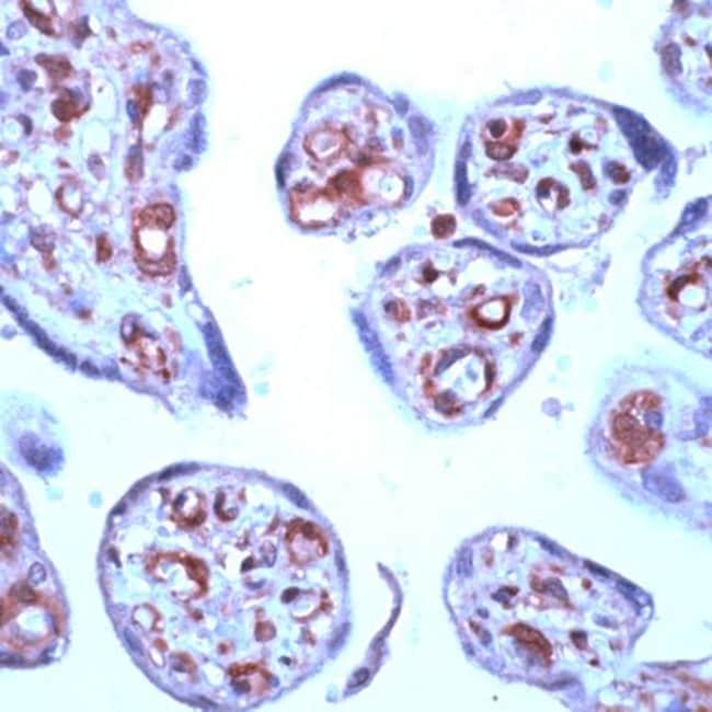 500UL STAT6 Polyclonal Antibody
