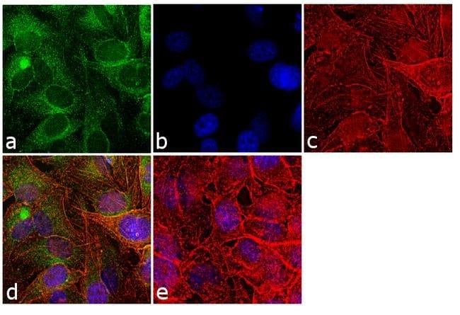 Anti-Cyclophilin B Polyclonal Antibody 1