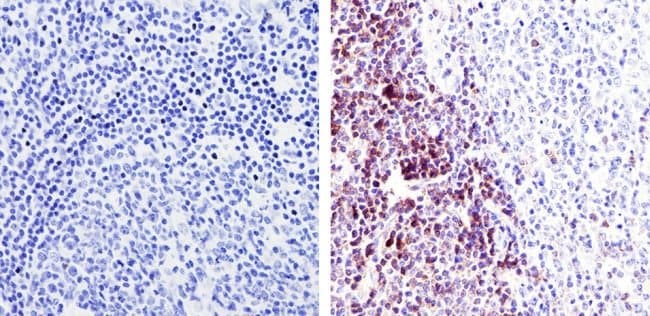 ANTI-HUMAN AF1 MAB 200µG