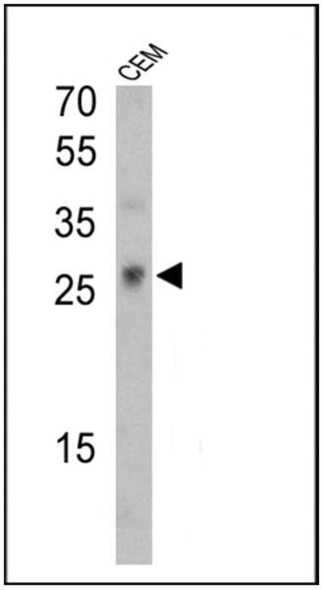 ANTI-HUMAN VG9 MAB 200µG