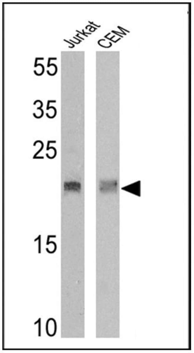 ANTI-HUMAN VD2 MAB 200µG
