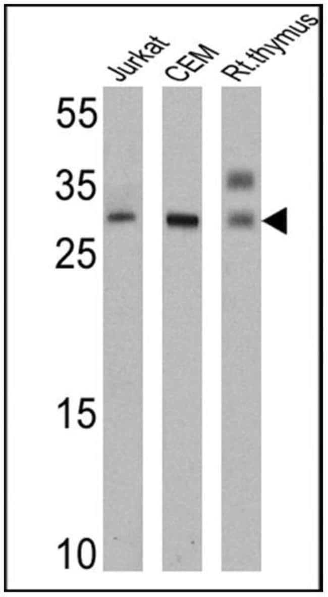 ANTI-HUMAN VA12.1 MAB 200µG