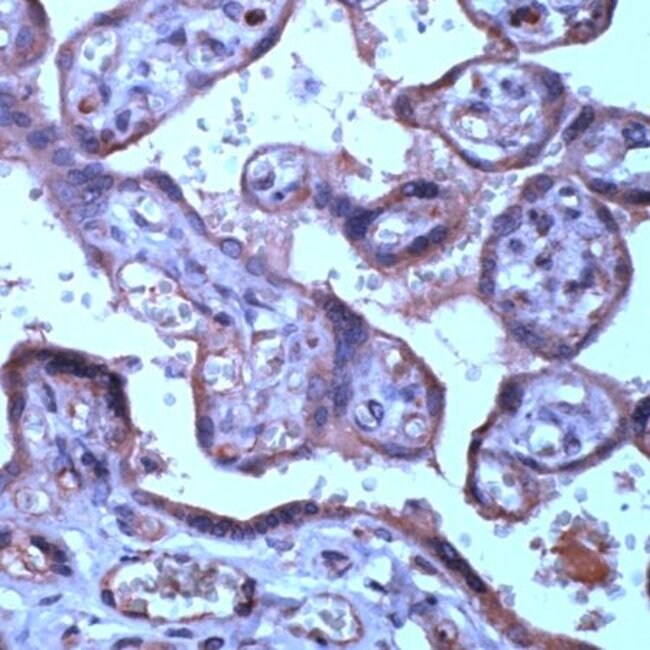 500uL Polyclonal antibody, TIMP-3, host