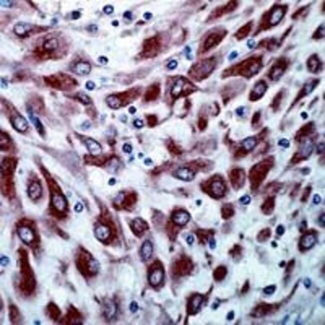 1 ML VEGF Receptor 4 Rabbit polyclonal a