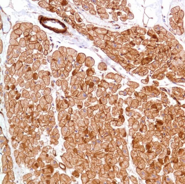 Anti-Vinculin