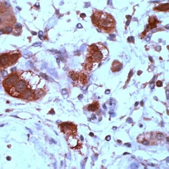 500uL Polyclonal antibody, XRCC2, host r