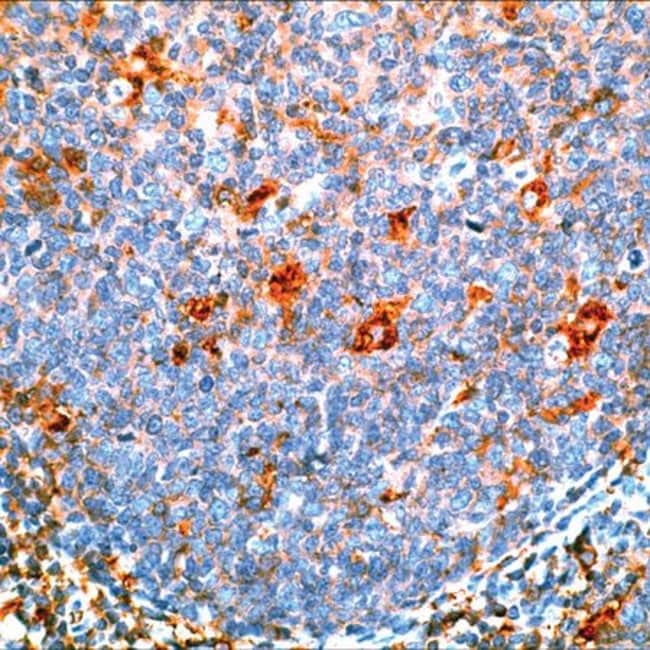 500uL Polyclonal antibody, alpha-1-antic