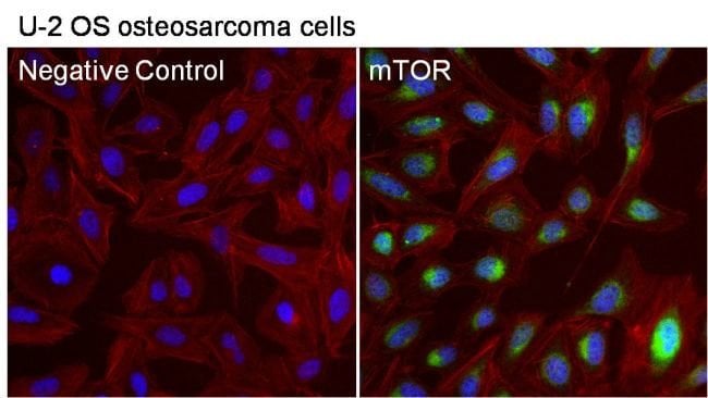 100 UG mTOR Antibody